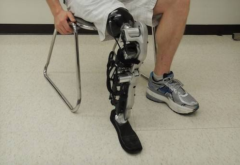 淺談膝關節(jié)對大腿截肢具有哪些重要性(圖1) 淺談膝關節(jié)對大腿截肢具有哪些重要性(圖1)