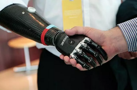 假肢價格注意事項(圖1) 假肢價格注意事項